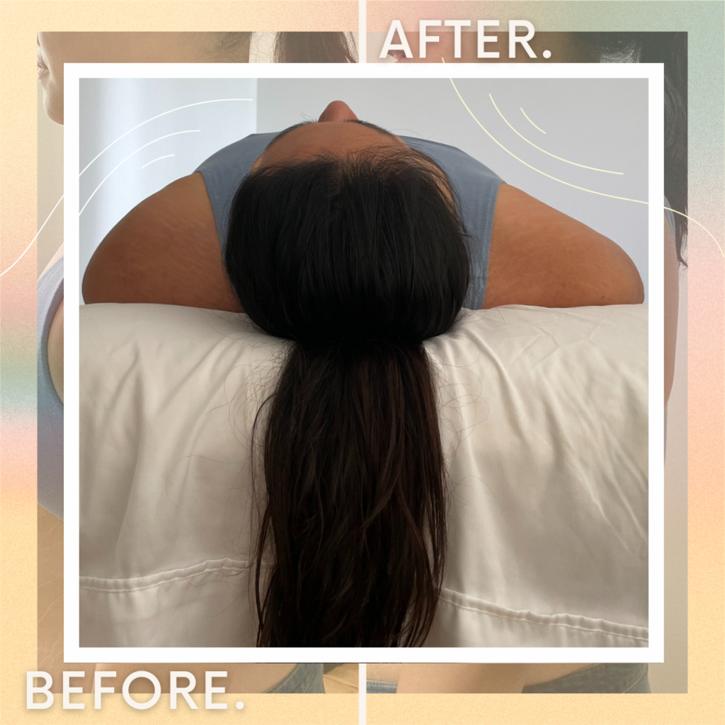 Myofascial massage
